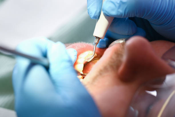 Best Weekend Emergency Dentist in Norwood, OK