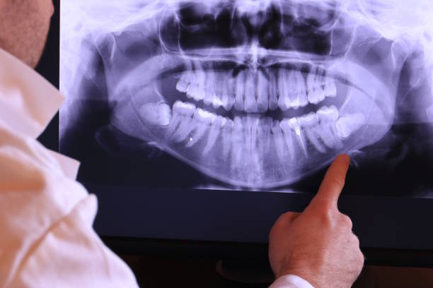 Best Emergency Tooth Extraction in Norwood, OK
